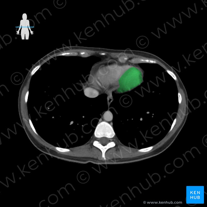 Left ventricle of heart (Ventriculus sinister cordis); Image: 