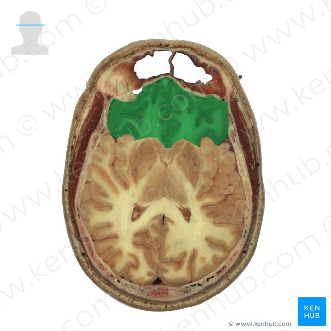 Frontal lobe (Lobus frontalis); Image: National Library of Medicine