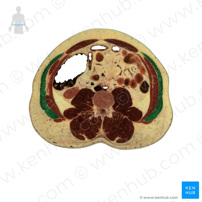 Músculo oblíquo externo do abdome (Musculus obliquus externus abdominis); Imagem: National Library of Medicine