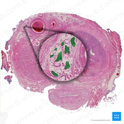 Nervio dorsal del pene (Nervus dorsalis penis); Imagen: 