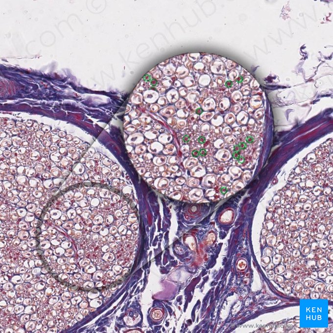 Axônio periférico amielínico (Axon nonmyelinatum periphericum); Imagem: 