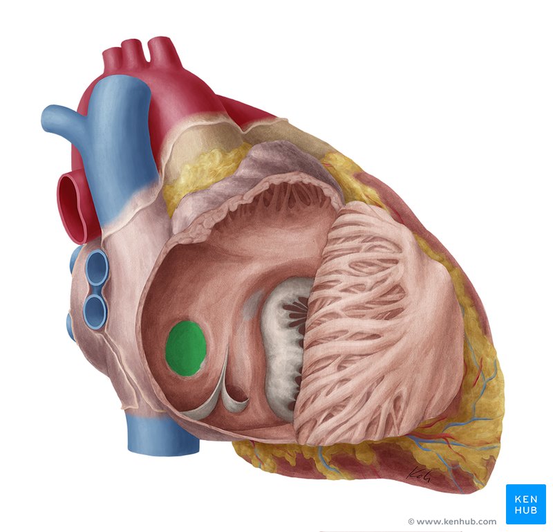 Fossa ovalis of the heart - lateral-right view