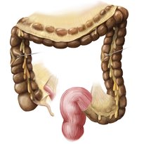 Large intestine