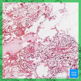 Medula óssea amarela (Medulla ossium flava); Imagem: 