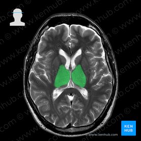 Brain MRI: How to read MRI brain scan | Kenhub
