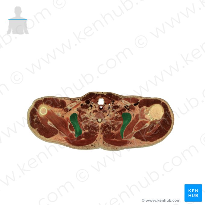 Músculo serrátil anterior (Musculus serratus anterior); Imagem: National Library of Medicine