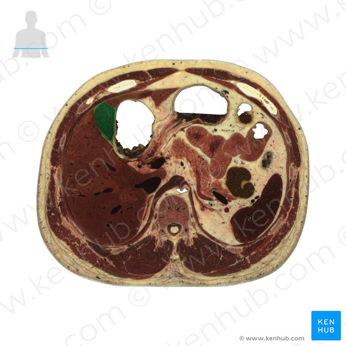 Gallbladder (Vesica biliaris); Image: National Library of Medicine