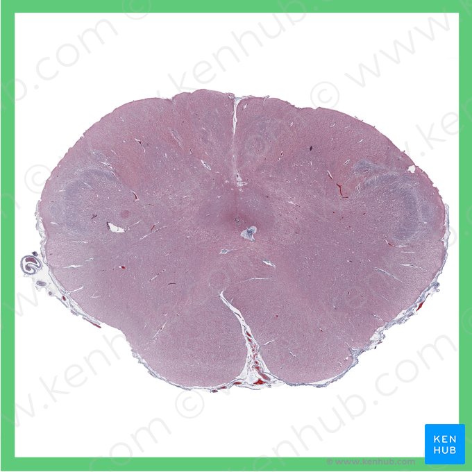 Medulla oblongata; Image: 