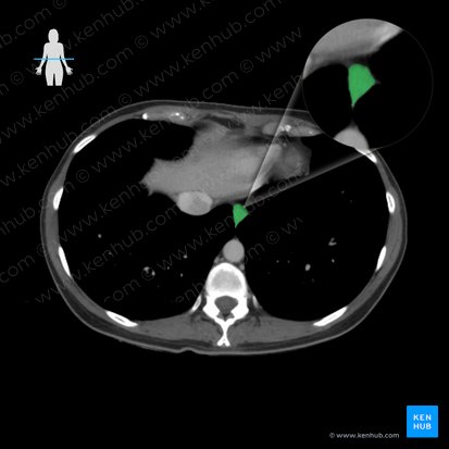 Esophagus (Oesophagus); Image: 