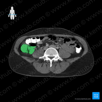 Ascending colon (Colon ascendens); Image: 