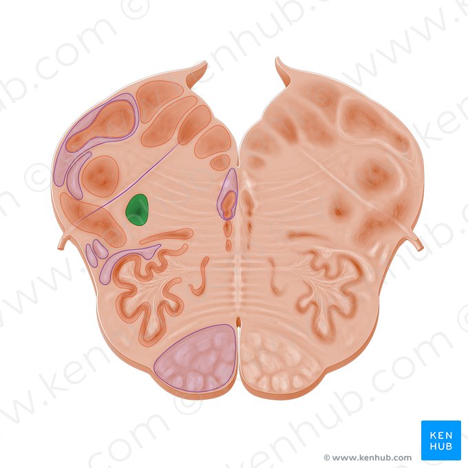 Nucleus ambiguus (Ambiguuskern); Bild: Paul Kim