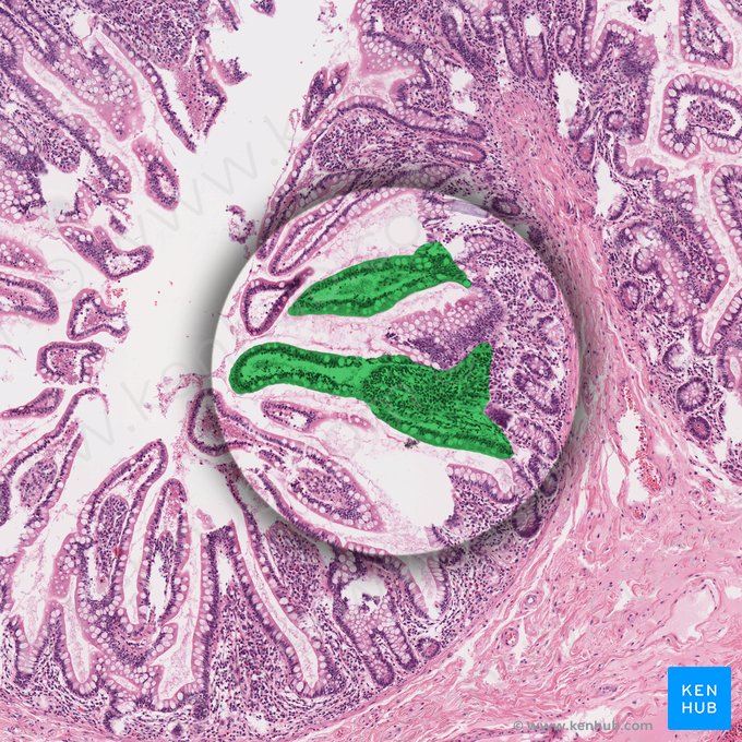 Vellosidad intestinal (Villus intestinalis); Imagen: 