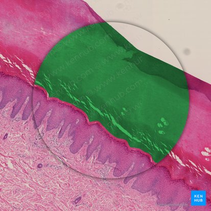 Stratum corneum epidermis (Hornschicht der Epidermis); Bild: 