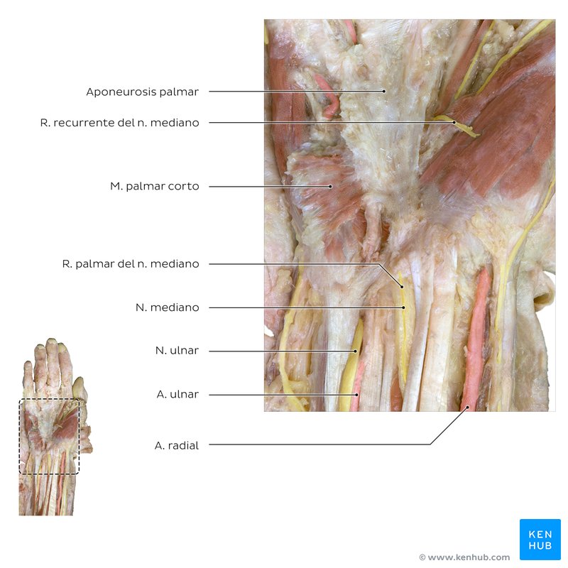 Disección del túnel carpiano en un cadaver.