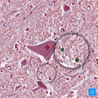 Neuroglia (Gliazellen); Bild: 