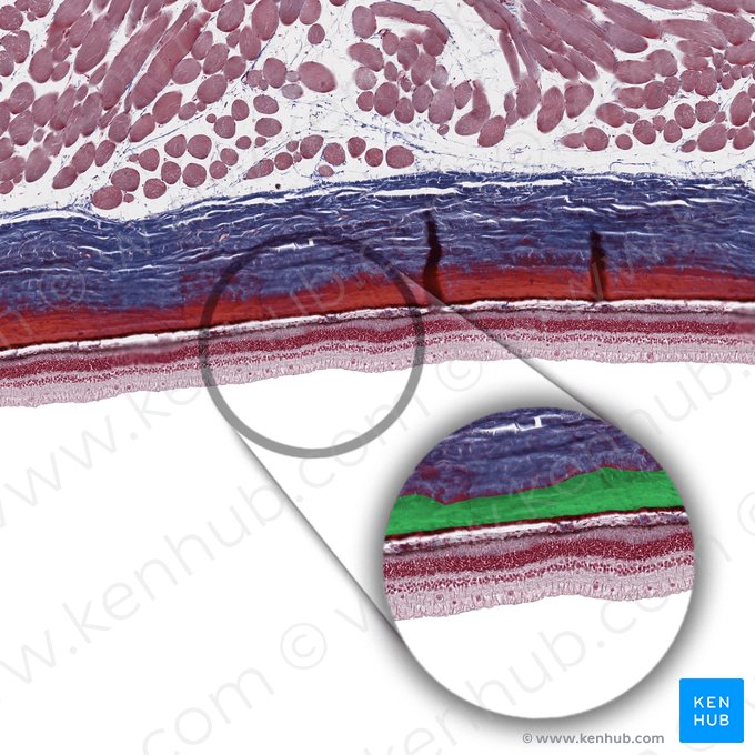 Choroid stroma; Image: 