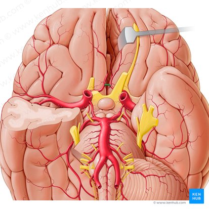 Anterior communicating artery (Arteria communicans anterior); Image: Paul Kim