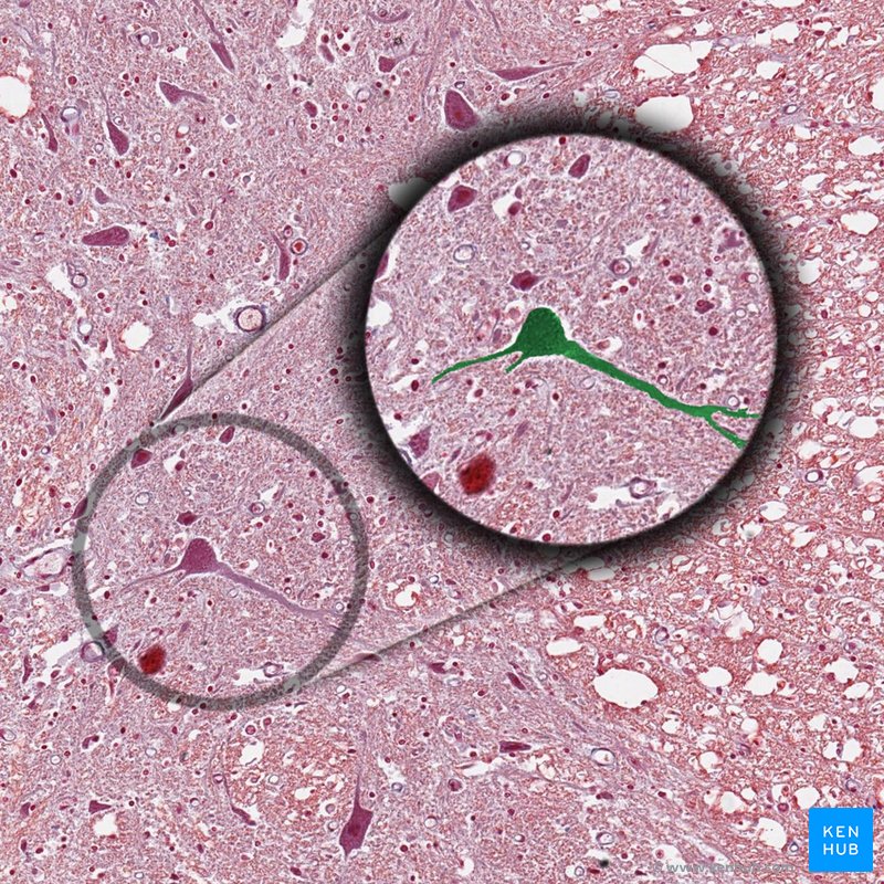 Multipolar neuron - histological slide