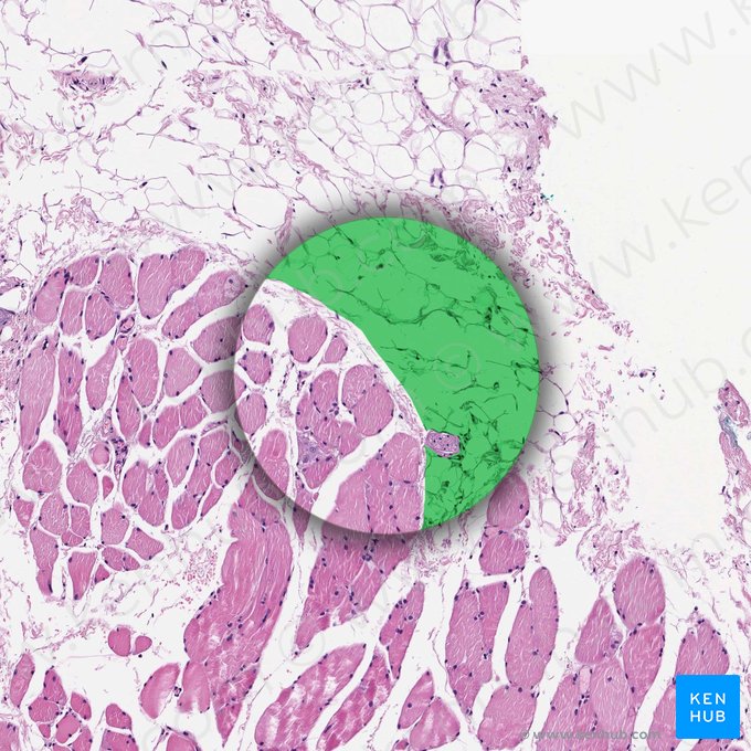 Perimuscular fat (Textus adiposus perimuscularis); Image: 