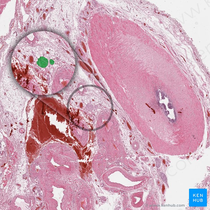 Genital branch of genitofemoral nerve (Ramus genitalis nervi genitofemoralis); Image: 