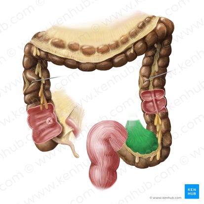 Mesocolon sigmoideum (Sigmoidgekröse); Bild: Begoña Rodriguez