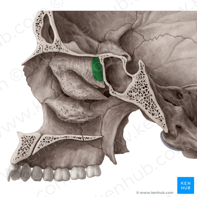 Recesso esfenoetmoidal (Recessus sphenoethmoidalis); Imagem: Yousun Koh