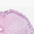 Tongue and epiglottis
