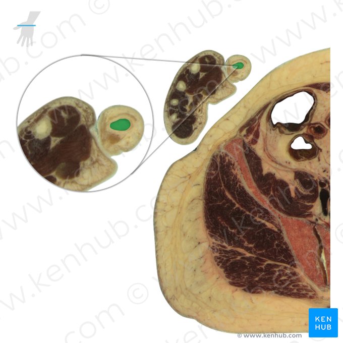 Phalanx proximalis pollicis (Grundglied des Daumens); Bild: National Library of Medicine