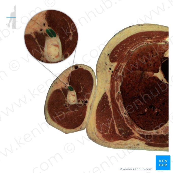 Musculus deltoideus (Deltamuskel); Bild: National Library of Medicine