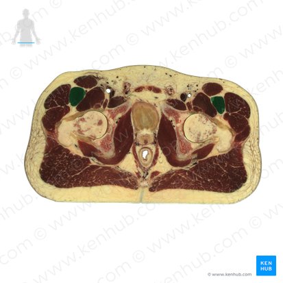 Musculus rectus femoris (Gerader Oberschenkelmuskel); Bild: National Library of Medicine