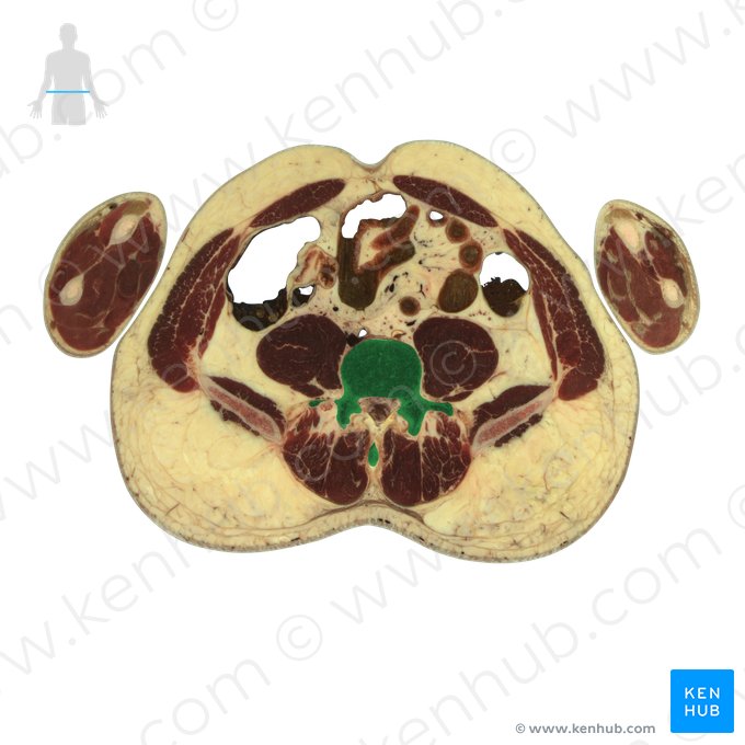 Vertebra L5; Image: National Library of Medicine