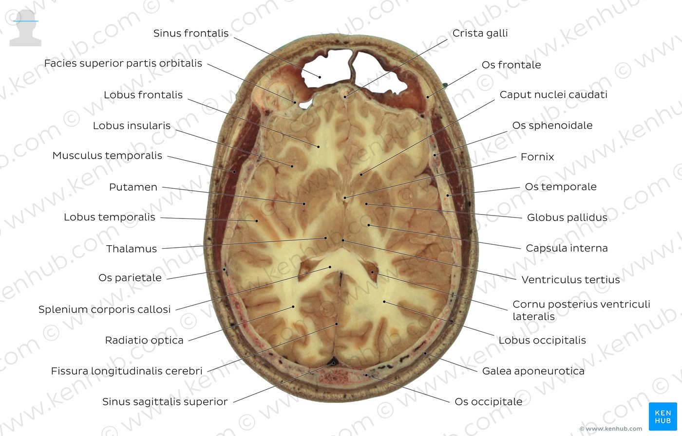 Schnittbild auf Höhe des Thalamus