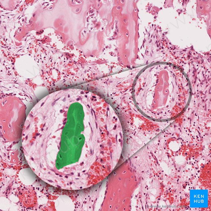 Mixed spicule (of bone and cartilage matrix) (Spicula mixta (matrix ossea et cartilaginea)); Image: 