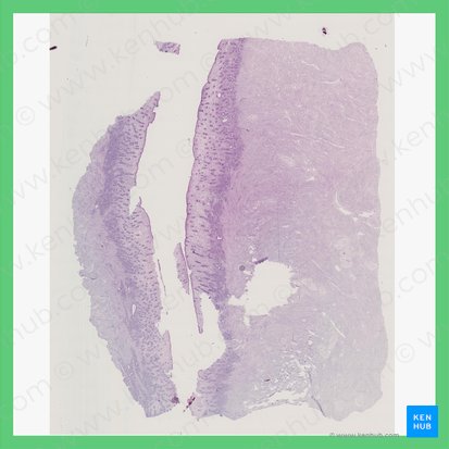 Phasis proliferativa intermedia (Uterus) (Mittlere Proliferationsphase des Uterus); Bild: 