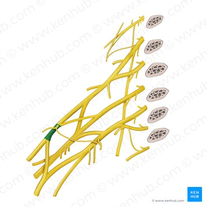 Fasciculus lateralis plexus brachialis (Seitliches Bündel des Armgeflechts); Bild: Begoña Rodriguez