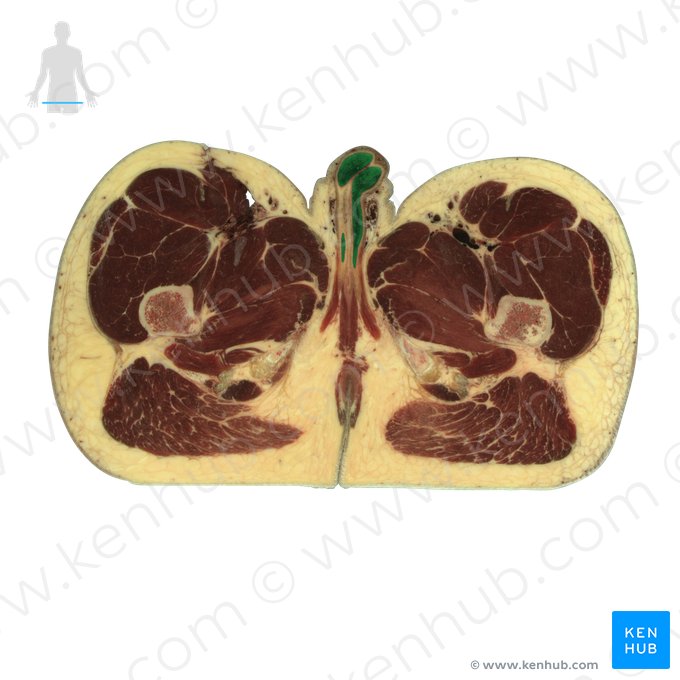 Corpus cavernosum of penis (Corpus cavernosum penis); Image: National Library of Medicine