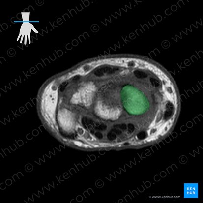 Scaphoid bone (Os scaphoideum); Image: 