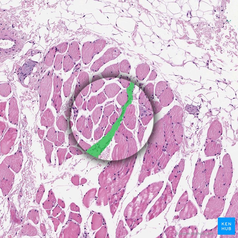 Perimysium - histological slide