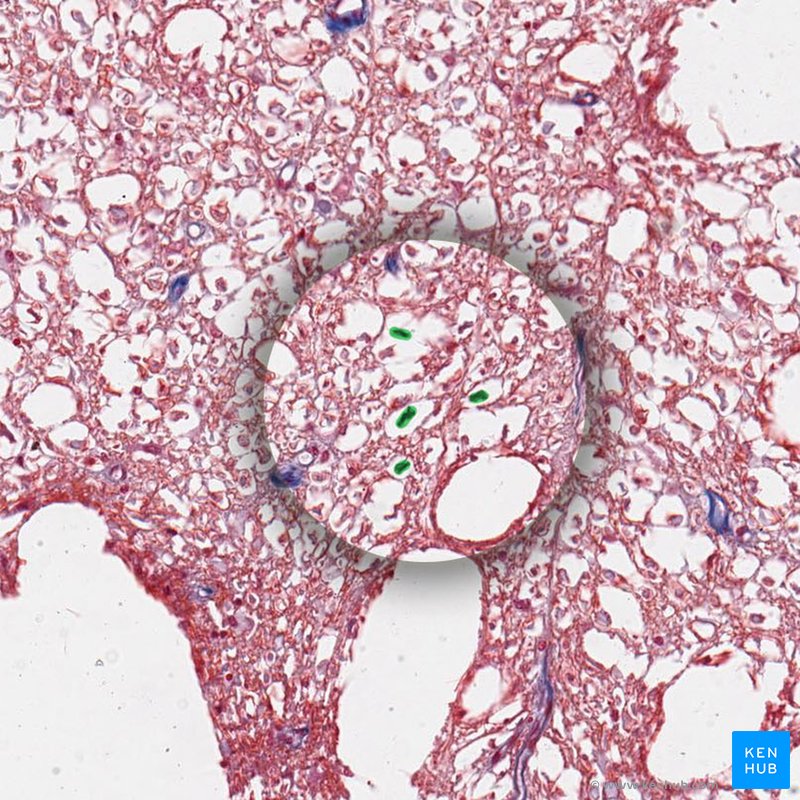 Microglial cells - histological slide