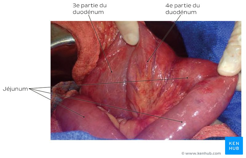Duodénum et jéjunum lors d'une intervention chirurgicale