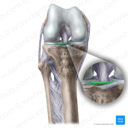 Ligamento transverso do joelho (Ligamentum transversum genus); Imagem: Liene Znotina