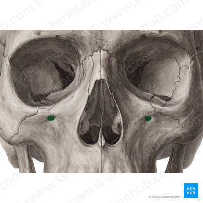 Foramen infraorbitale maxillae (Unteraugenhöhlenloch); Bild: Yousun Koh