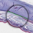 Perichondrium