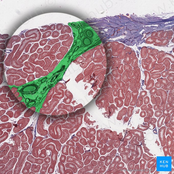 Mediastinum testis; Image: 