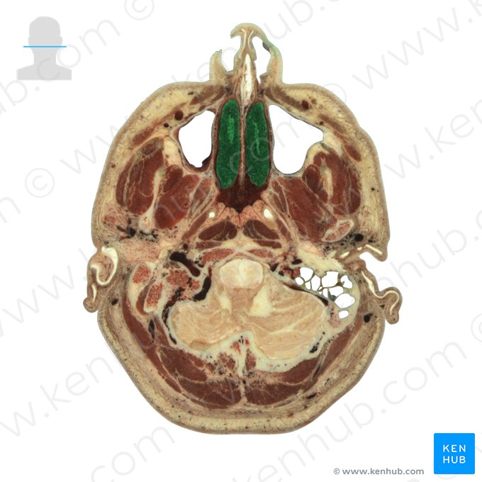 Concha nasalis inferior (Untere Nasenmuschel); Bild: National Library of Medicine