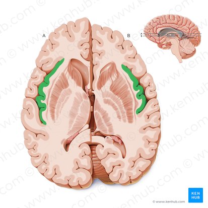 Insular lobe (Insula); Image: Paul Kim