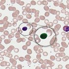 Lymphocytes