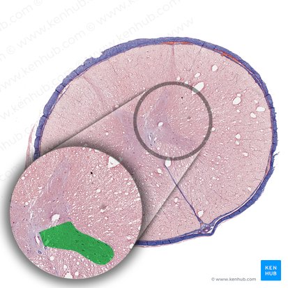 Cornu anterius medullae spinalis (Vorderhorn des Rückenmarks); Bild: 