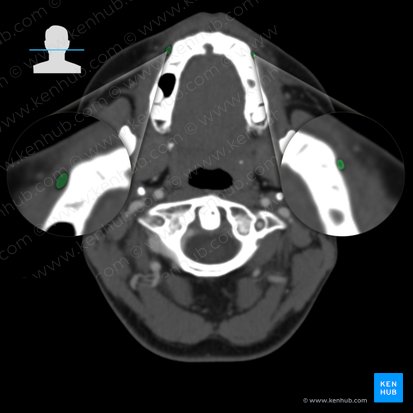 Vestíbulo oral (Vestibulum oris); Imagem: 