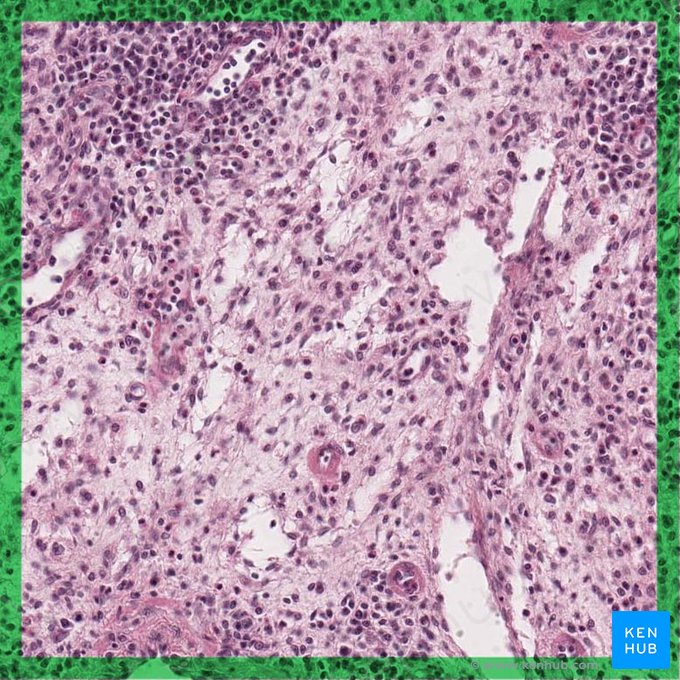 Reticular connective tissue; Image: 